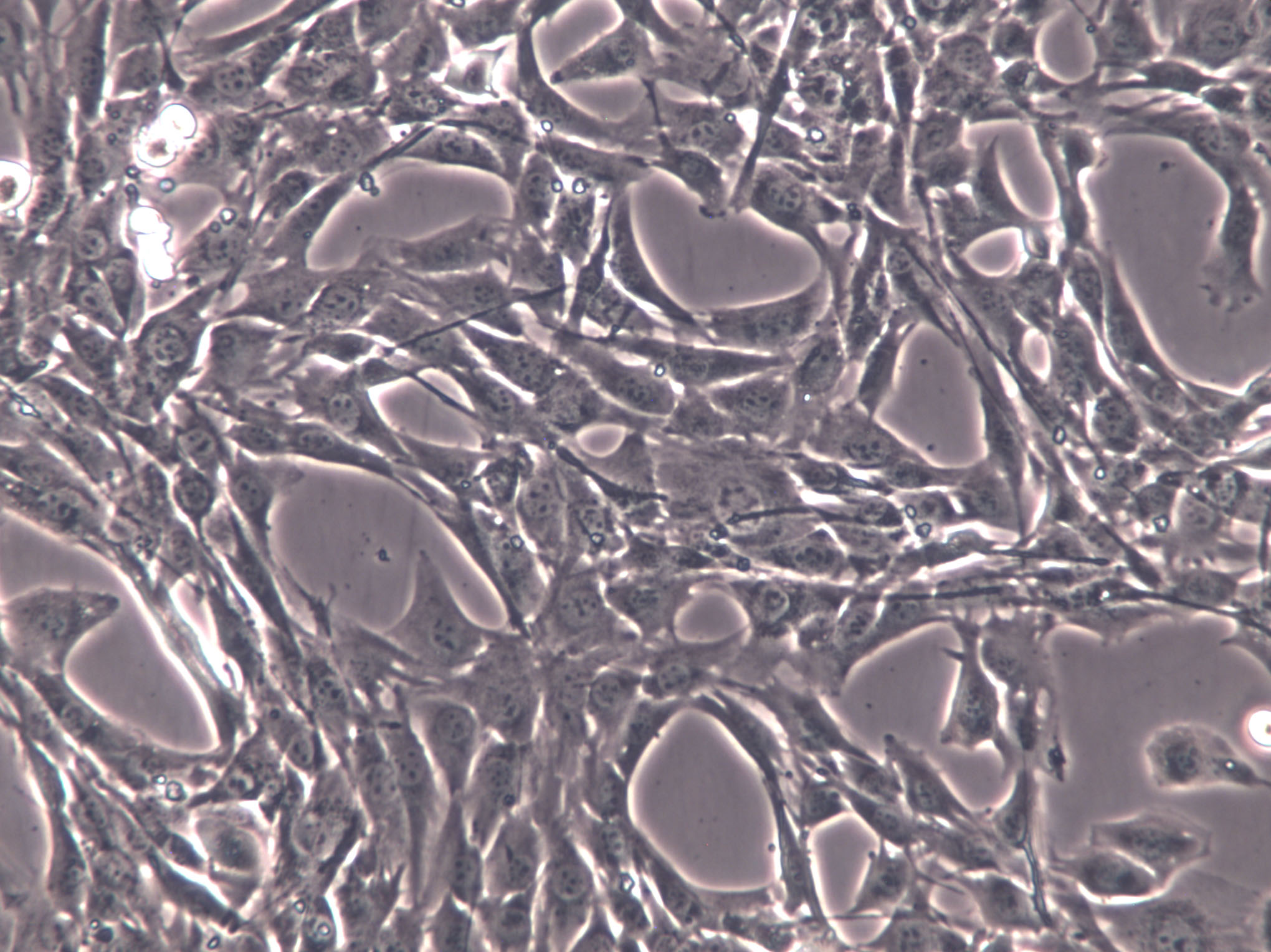 balb/3t3 clone a31 cells(赠送str鉴定报告|小鼠胚胎成纤维细胞