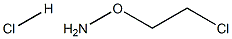 Hydroxylamine,O-(2-chloroethyl)-, hydrochloride (9CI) Structure