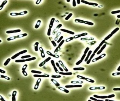 蜡样芽孢杆菌革兰染色图片