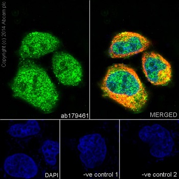 Anti-JNK1+JNK2+JNK3 antibody [EPR16797-211] (ab179461)