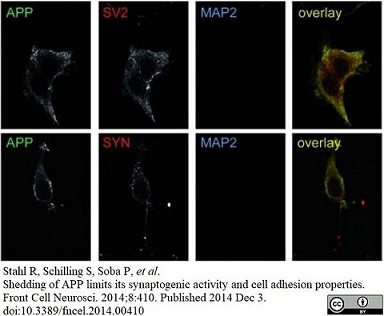 detection of c-myc tagged APP by immunofluorescence