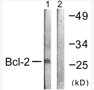 Anti-Bcl-2 antibody (ab59348)