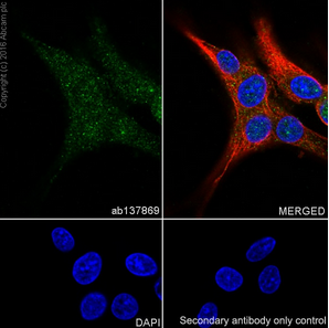 Anti-Tyrosine Hydroxylase antibody (ab137869)