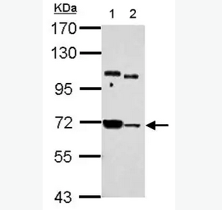 Western blot - Anti-Sts1 antibody (ab155307)