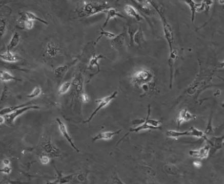 小鼠胶质瘤细胞