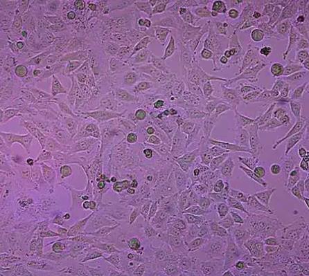 人宫颈癌细胞的应用