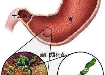 盐酸小檗碱的抗菌作用