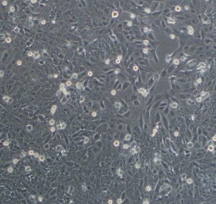 NCI-H2227人小细胞肺癌贴壁细胞系的应用