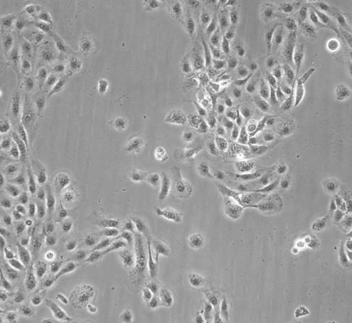 LN-18人神经胶质瘤贴壁细胞系的应用