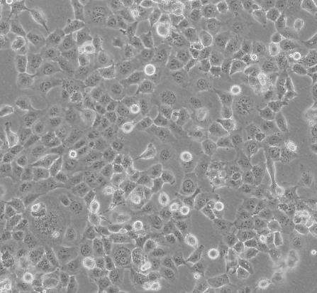 NCI-H69人小细胞肺癌贴壁细胞系的应用