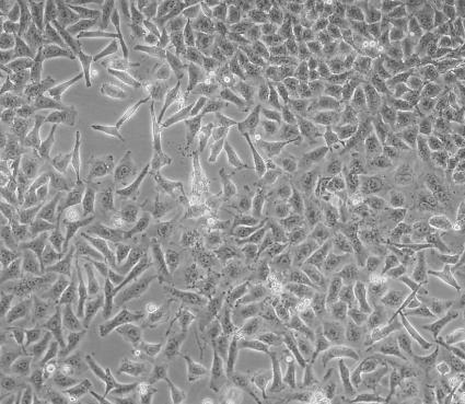 MGC80-3细胞系|人胃癌细胞的应用