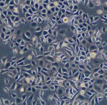 HSC-6细胞系|人口腔鳞癌细胞的应用