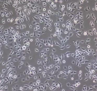 TCCSUP人膀胱移行细胞癌贴壁细胞系的应用