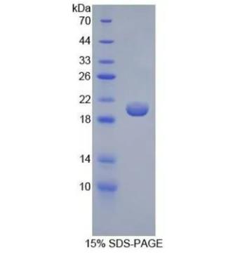 SDS-PAGE超低分子量标准品的应用