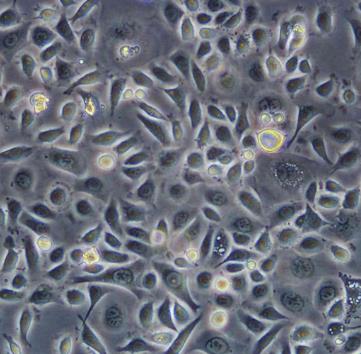 DMS153细胞系|人肺癌细胞的应用
