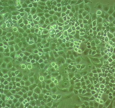 HOP-92人小细胞肺癌贴壁细胞系.png
