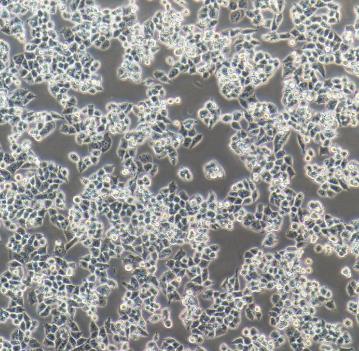OVISE人卵巢癌贴壁细胞系.png