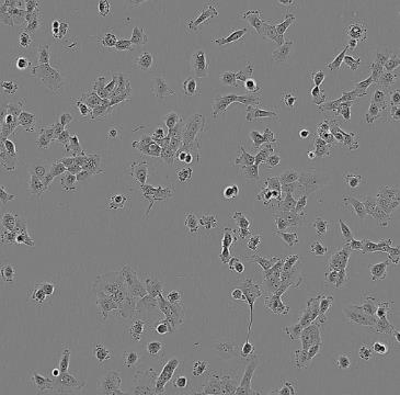 FTC-133 人甲状腺癌细胞系的应用