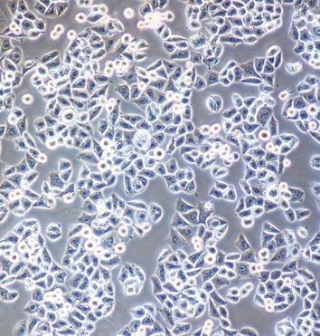 NCI-H2170人肺鳞癌贴壁细胞系的应用