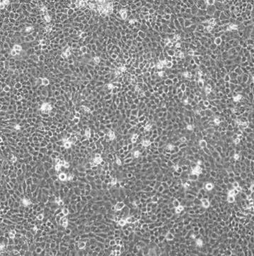 CAL-33人舌磷癌贴壁细胞系的应用