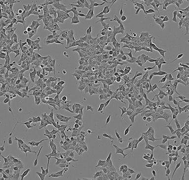 LK-2人肺癌贴壁细胞系.png