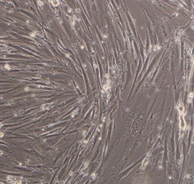 SK-LMS-1人阴户平滑肌肉瘤贴壁细胞系的应用