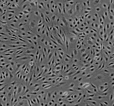 小鼠脑微血管内皮细胞株的应用