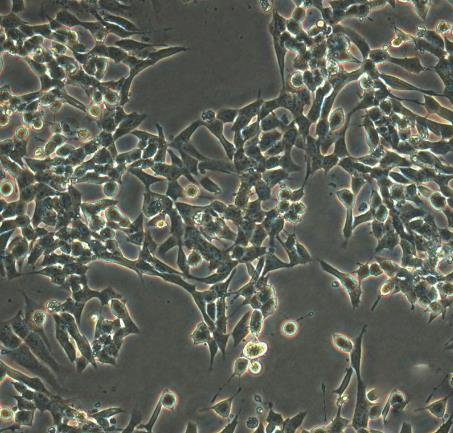 OCM-1A细胞系|人脉络膜黑色素瘤细胞