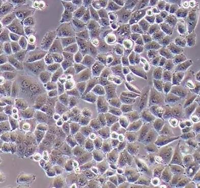 IOSE-29 人卵巢上皮细胞系的应用