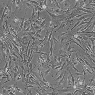 WML2 小鼠肺成纤维细胞系的应用