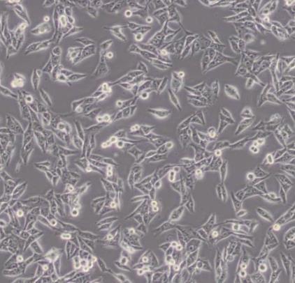 MDA-MB-435 人乳腺癌细胞系的应用