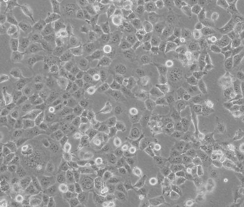 NCI-H2110人非小细胞肺癌贴壁细胞系的应用