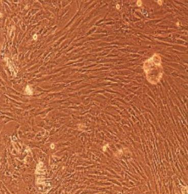 Pulmonary Fibroblasts Cells.png
