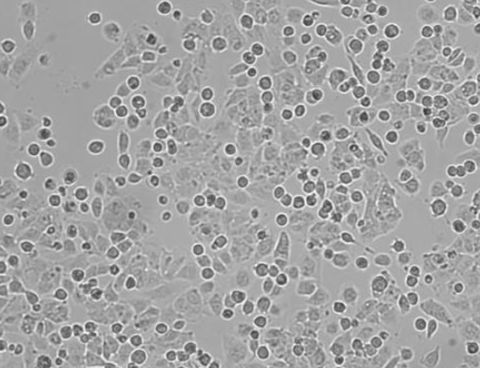 HCCLM3人高转移肝癌细胞
