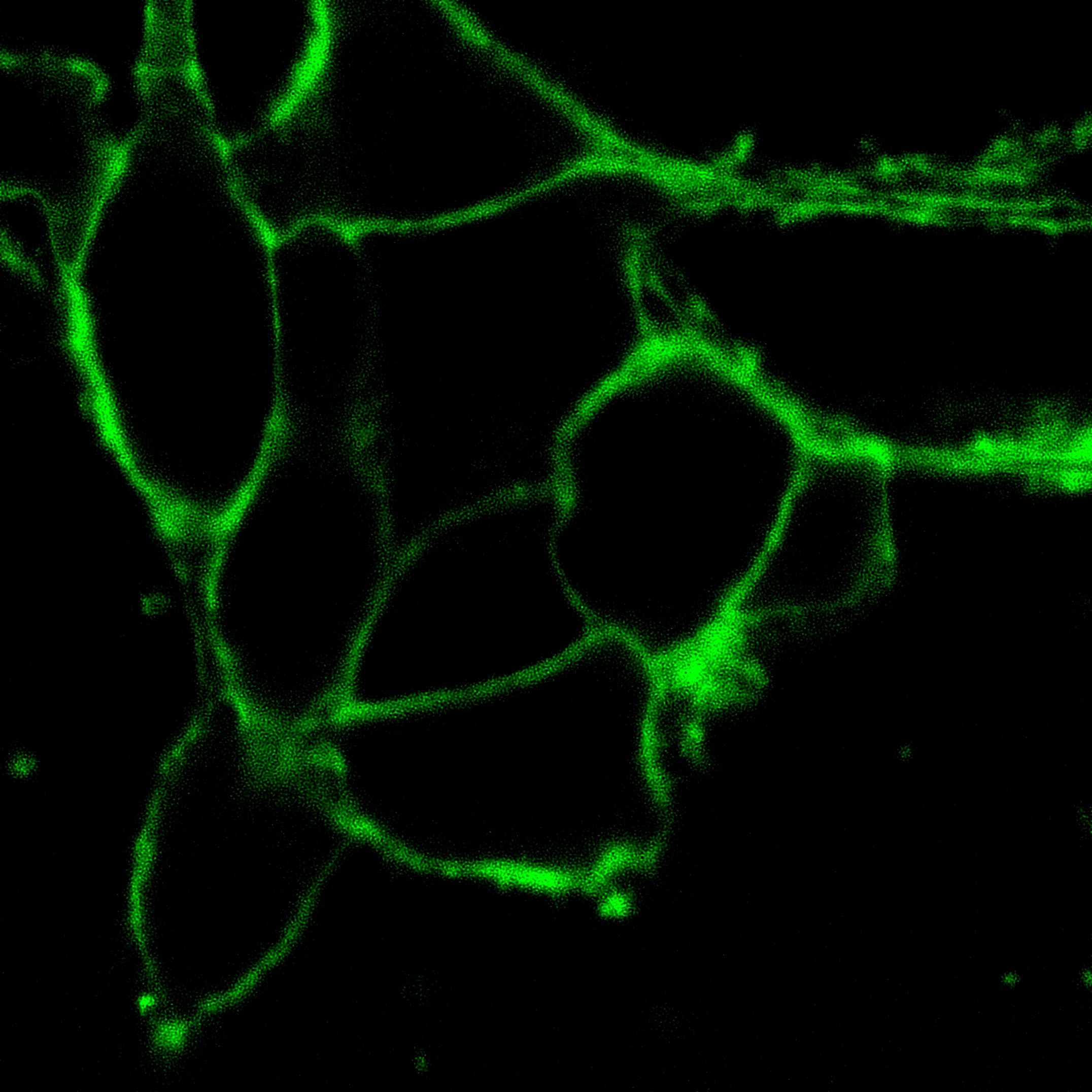 AIE Green Probe for Plasma Membrane