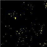 AIE Yellow Probe for Lipid droplets