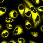 AIE Yellow Probe for Endoplasmic Reticulum pictures