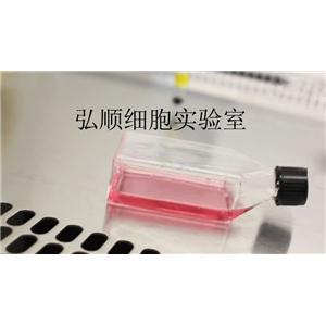 NCI-H520细胞|人肺腺鳞癌细胞(提供Str鉴定报告)