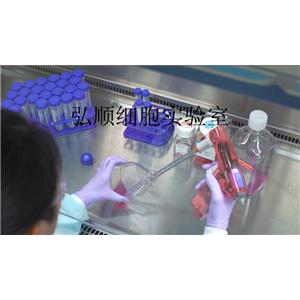 ACC-2细胞系|人涎腺腺样囊性癌细胞