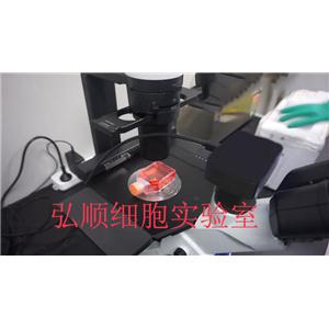 NCI-H2452 Cell<人间皮瘤细胞系>