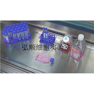 ACC-2 Cell<人涎腺腺样囊性癌细胞系>