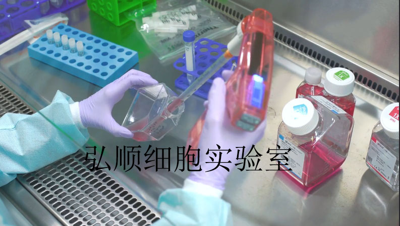 Mkn 28 Mkn 74 Cell Line 人胃癌高转移细胞价格厂家 上海弘顺生物科技有限公司