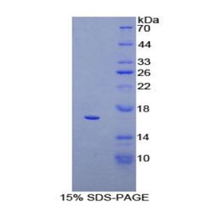 CD160分子(CD160)重组蛋白