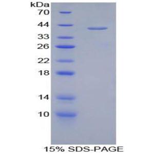 Corin蛋白(CRN)重组蛋白