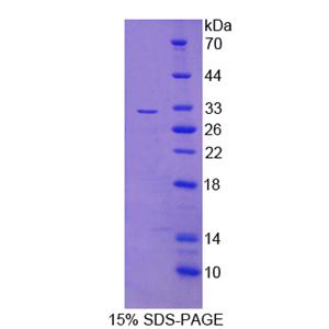 C-Ros癌基因1(ROS1)重组蛋白