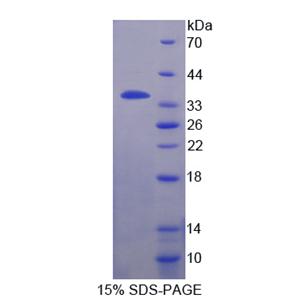 Fidgetin蛋白(FIGN)重组蛋白