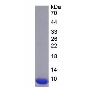 兴奋性氨基酸转运蛋白2(EAAT2)重组蛋白