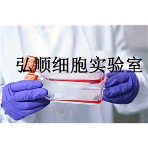 ACC-3人涎腺腺样囊性癌贴壁细胞系