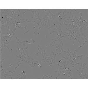 ACC-2 人涎腺腺样囊性癌细胞系