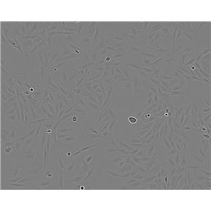 ACC-3细胞：人涎腺腺样囊性癌细胞系